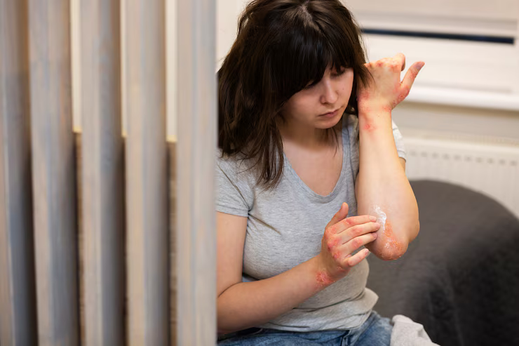 MySmartCare360 | WOUND Healing For Women -  Image Name 